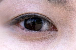 2025年最新版！新宿で評判の糸リフト治療を成功させるための完全ガイド